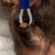 Tick Remover